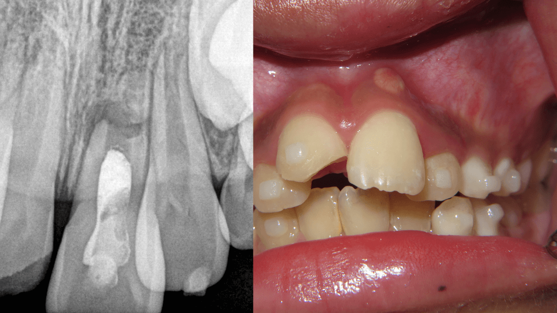 Case 1